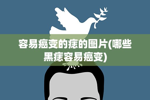 容易癌变的痣的图片(哪些黑痣容易癌变)