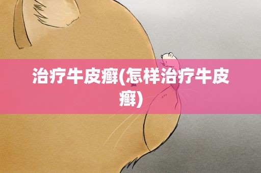 治疗牛皮癣(怎样治疗牛皮癣)