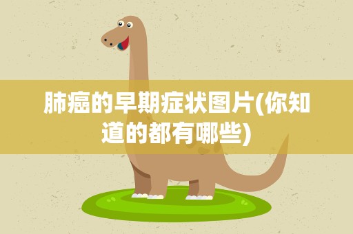 肺癌的早期症状图片(你知道的都有哪些)