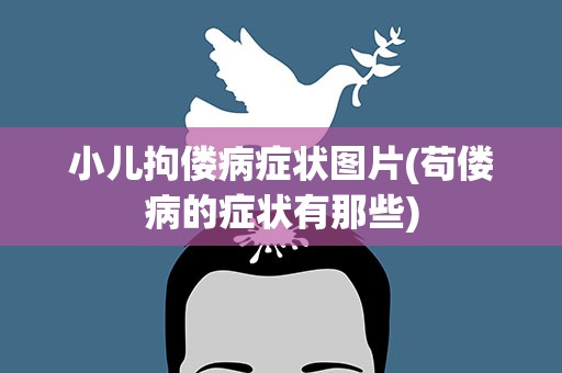 小儿拘偻病症状图片(苟偻病的症状有那些)